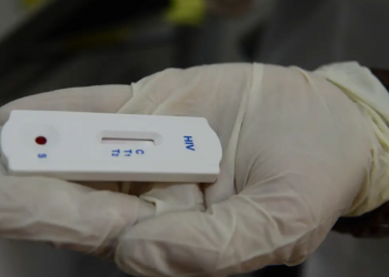 Valadares registra 85 casos de HIV em adultos; notificação de sífilis ultrapassa de 400