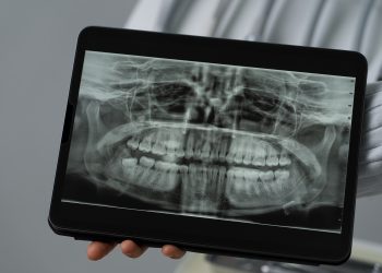Professores de Odontologia da UFJF-GV lançam e-book gratuito