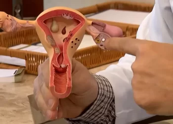 Endometriose: conheça os sintomas e saiba como tratar a doença