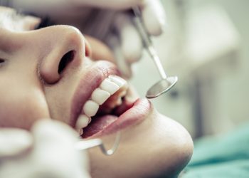 Univale realiza mutirão gratuito de prevenção ao câncer de boca nesta sexta