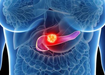 Câncer de pâncreas: quando a dificuldade no diagnóstico faz toda a diferença