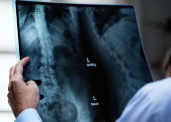 jovem esconde carregador de celular no estômago em Valadares