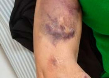 Mulher denuncia agressão do companheiro em São Félix de Minas