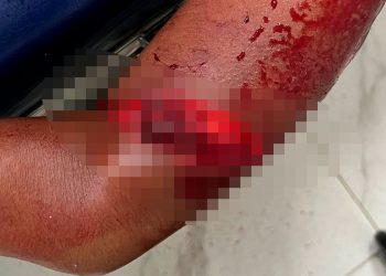 Homem tenta matar ex-companheira com golpes de foice em Tarumirim; suspeito se entrega à polícia