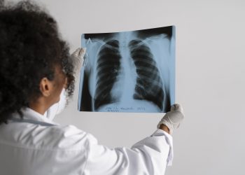 Prefeitura esclarece boatos sobre tuberculose em Valadares